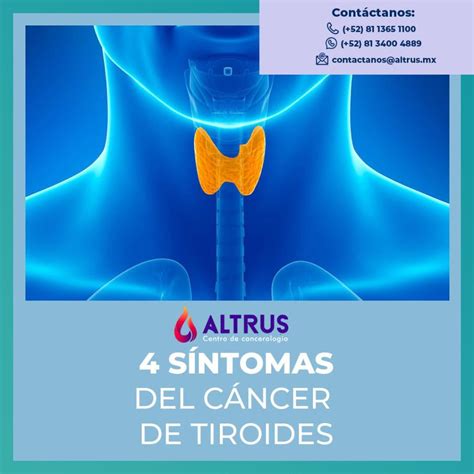 cancer de tiroides sintomas-1